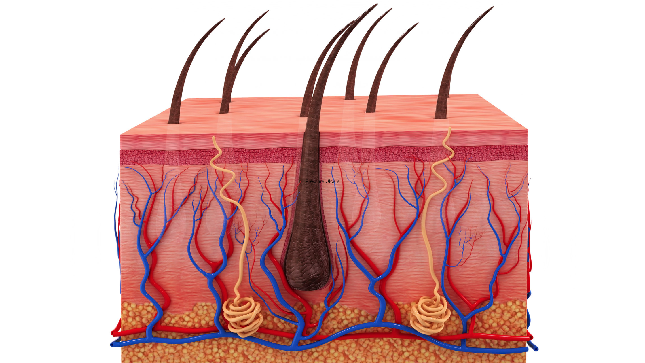 Pressure Ulcers Nclex Review For Nursing Students Free Download